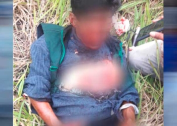 La persona herida en Santa Bárbara | Foto: Radio Fides