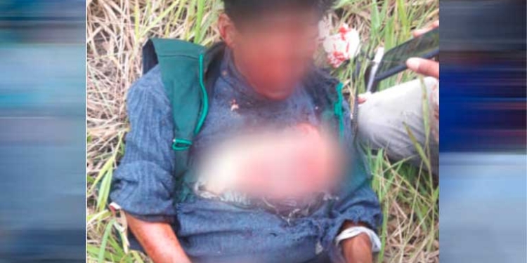 La persona herida en Santa Bárbara | Foto: Radio Fides