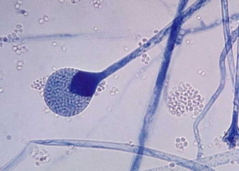 La mucormicosis |Imagen: CDC/Dr. Lucilie K. Georg