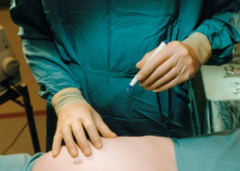 Mujer fallece luego de realizarse una lipoescultura