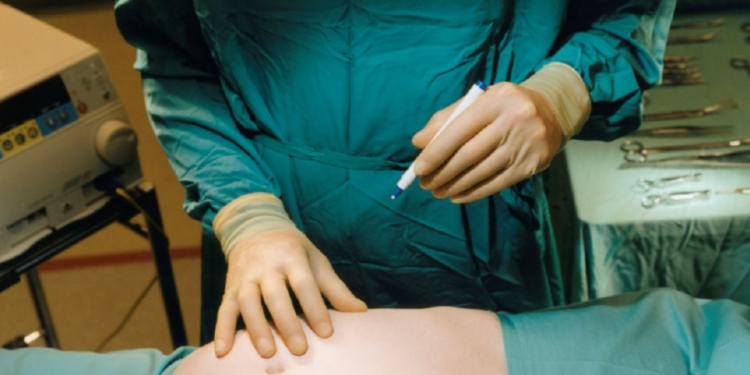 Mujer fallece luego de realizarse una lipoescultura