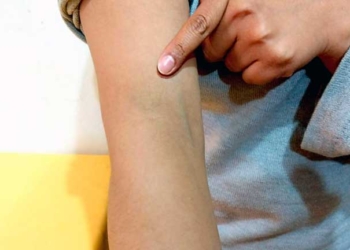 La periodista muestra las agresiones que sufrió por parte de los afines a Morales. Foto: ANP
