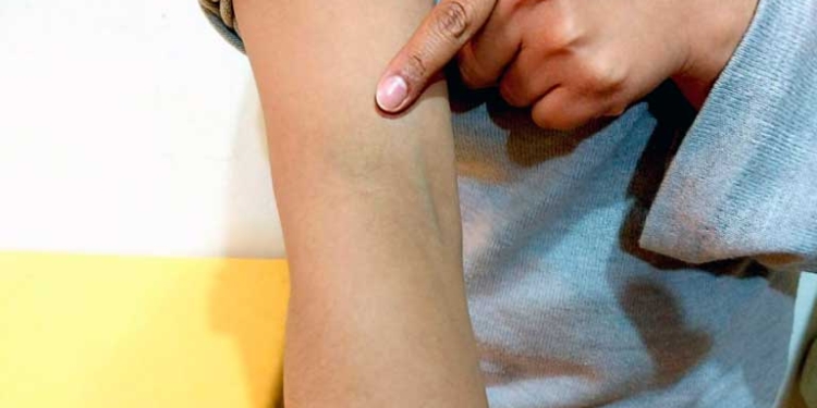 La periodista muestra las agresiones que sufrió por parte de los afines a Morales. Foto: ANP