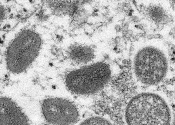 © CDC/Cynthia S. Goldsmith
La viruela del mono es una infección rara pero peligrosa, similar al ya erradicado virus de la viruela.