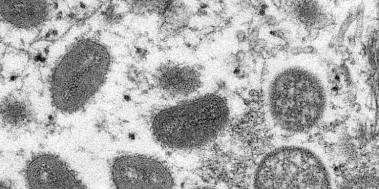 © CDC/Cynthia S. Goldsmith
La viruela del mono es una infección rara pero peligrosa, similar al ya erradicado virus de la viruela.