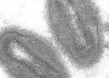 Virus de la viruela del simio (Monkeypox). Wikimedia Commons / University of Wisconsin-La Crosse