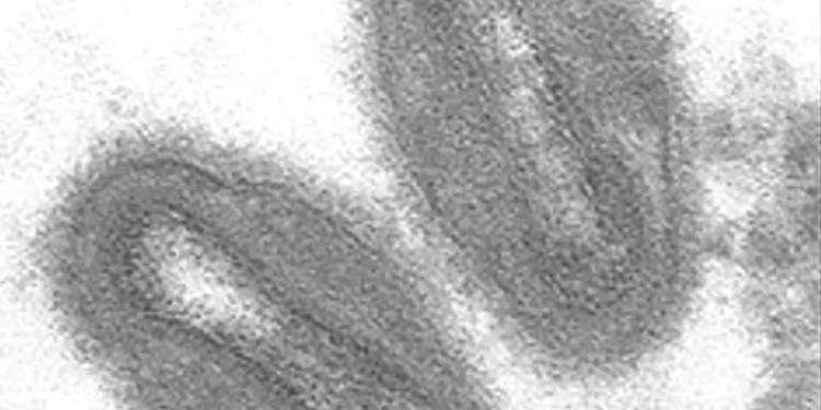 Virus de la viruela del simio (Monkeypox). Wikimedia Commons / University of Wisconsin-La Crosse