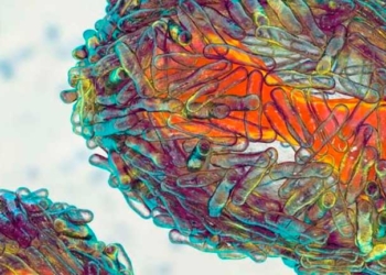 Suman 11 casos de viruela del mono en capital cruceña