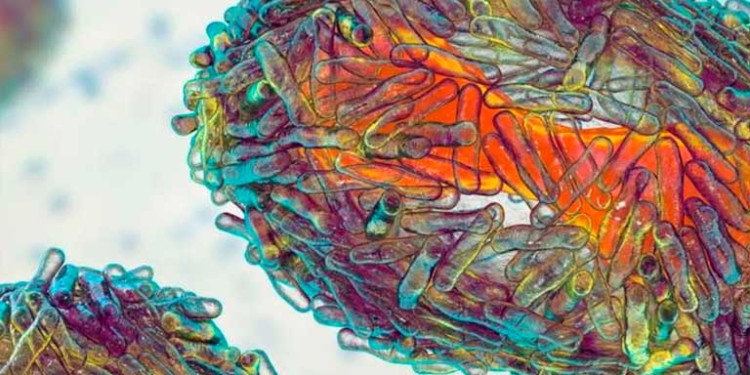 Suman 11 casos de viruela del mono en capital cruceña