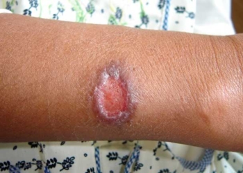 Foto referencial, Ministerio de Salud