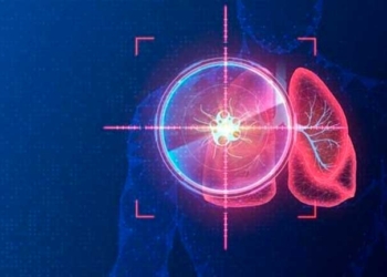 La terapia dirigida actúa sólo en células con mutaciones genéticas específicas | Getty images